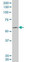 Anti-FLI1 Mouse Monoclonal Antibody [clone: 2G8]