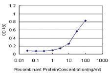 Anti-CK17 Mouse Monoclonal Antibody [clone: 2D10]