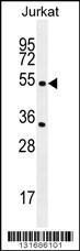 Anti-CHRNA2 Rabbit Polyclonal Antibody (APC (Allophycocyanin))