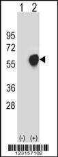 Anti-PDHA1 Rabbit Polyclonal Antibody (FITC (Fluorescein Isothiocyanate))