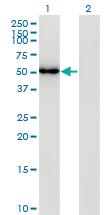 Anti-FLI1 Mouse Monoclonal Antibody [clone: 2G8]