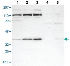 Anti-RRP7A Rabbit Polyclonal Antibody