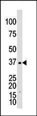 Anti-GALK1 Rabbit Polyclonal Antibody (APC (Allophycocyanin))