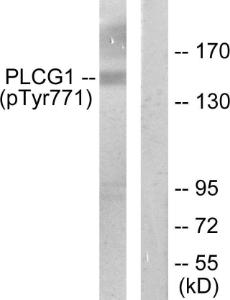 Western blot analysis of lysates from COS7 cells treated with EGF 200ng/ml 30' using Anti-PLCG1 (phospho Tyr771) Antibody. The right hand lane represents a negative control, where the antibody is blocked by the immunising peptide