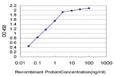 Anti-ESM1 Mouse Monoclonal Antibody [clone: 6D4]