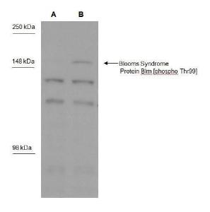 Anti-TET1 Rabbit Polyclonal Antibody