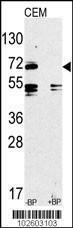 Anti-TLR2 Rabbit Polyclonal Antibody (FITC (Fluorescein))