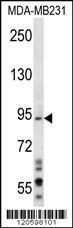 Anti-MAD1L1 Rabbit Polyclonal Antibody (APC (Allophycocyanin))