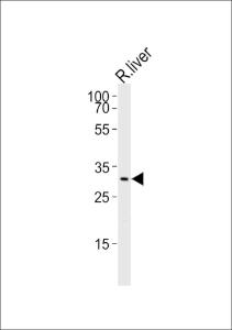 Anti-CEBPB Rabbit Polyclonal Antibody