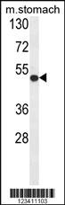 Anti-FERMT1 Rabbit Polyclonal Antibody