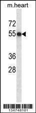 Anti-CSNK1D Rabbit Polyclonal Antibody (APC (Allophycocyanin))