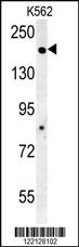 Anti-ADCY10 Rabbit Polyclonal Antibody