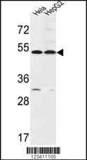 Anti-OR6Q1 Rabbit Polyclonal Antibody