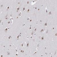 Anti-RRP7A Rabbit Polyclonal Antibody