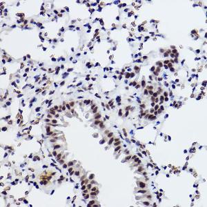 Anti-SNRPA1 Rabbit Monoclonal Antibody [clone: ARC2532]