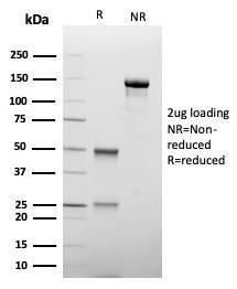 SDS-PAGE analysis of Anti-TIM3 Antibody [TIM3/4027] under non-reduced and reduced conditions; showing intact IgG and intact heavy and light chains, respectively. SDS-PAGE analysis confirms the integrity and purity of the antibody