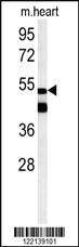 Anti-RAB11B Rabbit Polyclonal Antibody