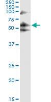 Anti-PFKFB3 Antibody Pair