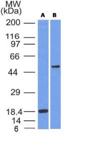 Western blot analysis of (A) recombinant SOX10 protein and (B) A375 cell lysate using Anti-SOX10 Antibody [SOX10/991]