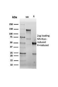 SDS-PAGE analysis of Anti-CD38 Antibody [CD38/6448R] under non-reduced and reduced conditions; showing intact IgG and intact heavy and light chains, respectively. SDS-PAGE analysis confirms the integrity and purity of the antibody.