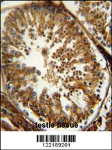 Anti-PAOX Rabbit Polyclonal Antibody