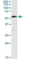 Anti-PFKFB3 Polyclonal Antibody Pair