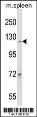 Anti-COL19A1 Rabbit Polyclonal Antibody (AP (Alkaline Phosphatase))