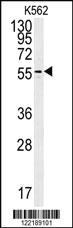 Anti-PAOX Rabbit Polyclonal Antibody