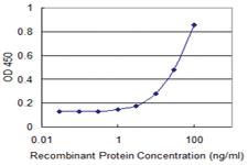 Anti-TTLL1 Mouse Monoclonal Antibody [clone: 2C6]