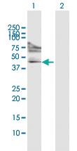 Anti-FOXP3 Rabbit Polyclonal Antibody