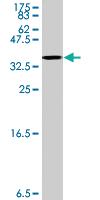 Anti-STOM Mouse Polyclonal Antibody