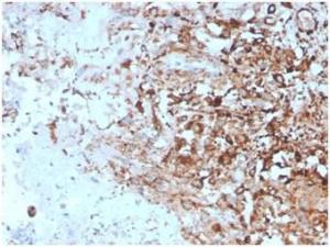 Immunohistochemical analysis of formalin-fixed, paraffin-embedded human lymph node tissue using Anti-TIM3 Antibody [TIM3/4027]