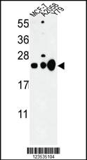 Anti-CBX1 Rabbit Polyclonal Antibody