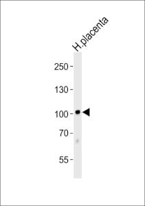 Anti-P3H1 Rabbit Polyclonal Antibody