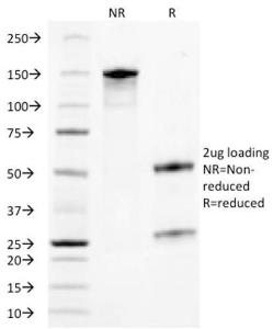 Anti-TROP2 antibody