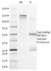 Antibody anti-CD20 B9E9 100 µg