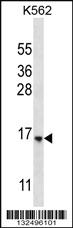 Anti-STARD5 Rabbit Polyclonal Antibody