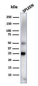 Western blot analysis of human spleen tissue lysate using Anti-TIM3 Antibody [TIM3/4027]