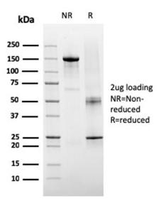 SDS-PAGE analysis of Anti-TIGIT Antibody [TIGIT/3106] under non-reduced and reduced conditions; showing intact IgG and intact heavy and light chains, respectively SDS-PAGE analysis confirms the integrity and purity of the antibody