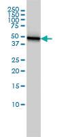 Anti-CK18 Mouse Monoclonal Antibody [clone: 2F8]