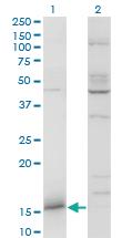 Anti-IFITM3 Mouse Monoclonal Antibody [clone: 2H4-1D5]