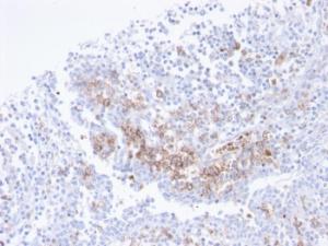 Immunohistochemical analysis of formalin-fixed, paraffin-embedded human tonsil using Anti-CD38 Antibody [CD38/4247R]