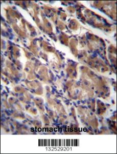 Anti-ABRA Rabbit Polyclonal Antibody