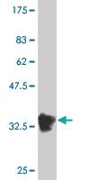 Anti-BOLL Mouse Monoclonal Antibody [clone: 1C3]