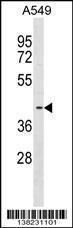 Anti-FADS3 Rabbit Polyclonal Antibody