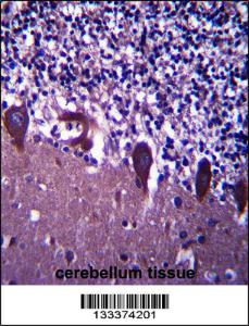 Anti-TLE6 Rabbit Polyclonal Antibody (PE (Phycoerythrin))