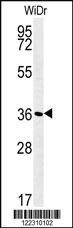 Anti-ATP1B1 Rabbit Polyclonal Antibody