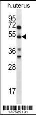 Anti-ABRA Rabbit Polyclonal Antibody