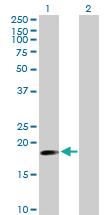 Anti-TNFAIP8 Mouse Polyclonal Antibody