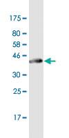 Anti-CK75 Mouse Monoclonal Antibody [clone: 3F9]